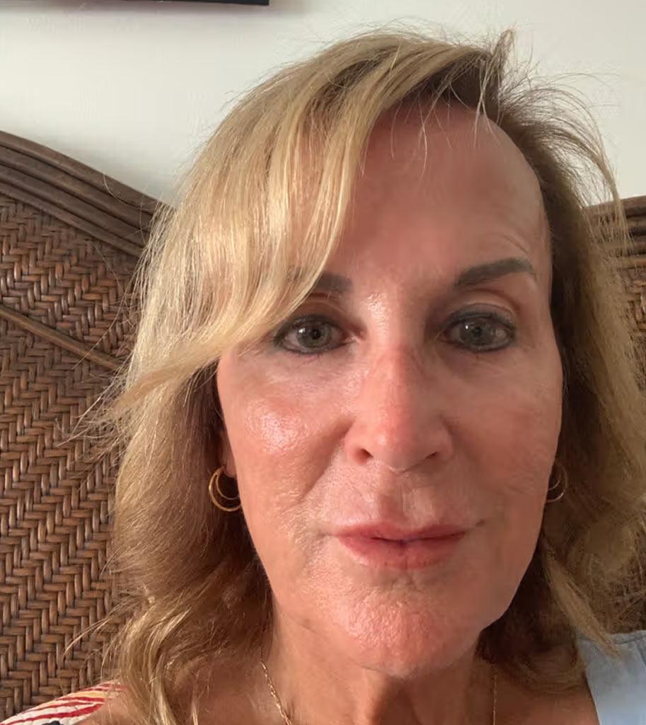 Before After GIF - Review 2