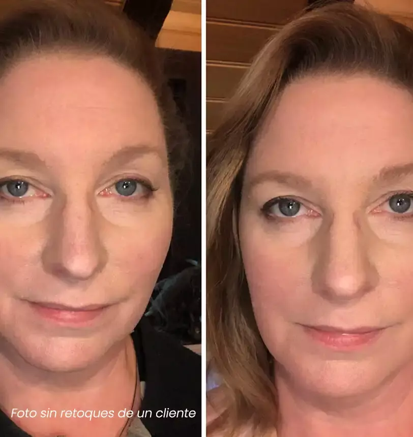 Client Testimonial Before After