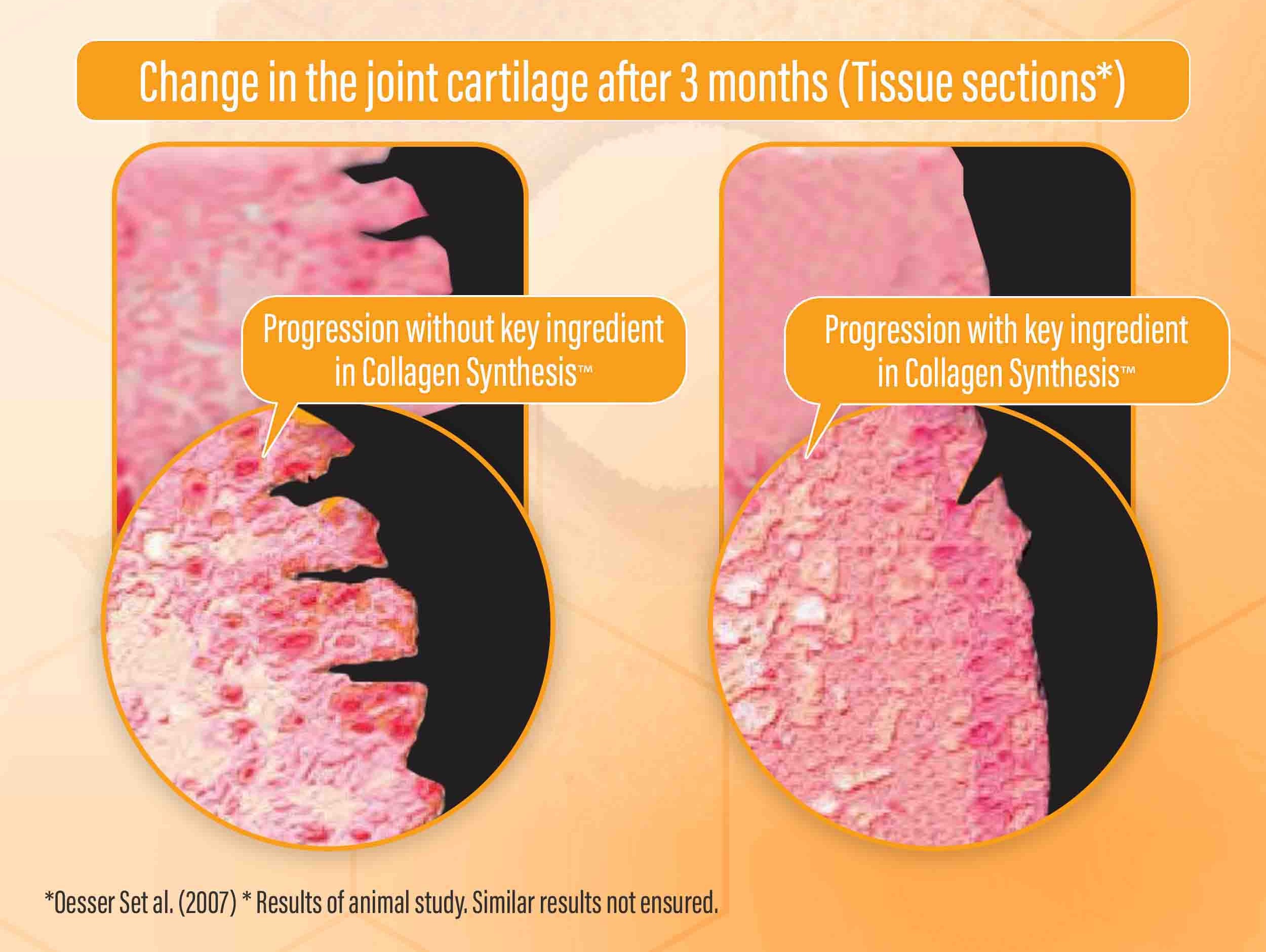 Collagen Synthesis ligament repair Fortigel image