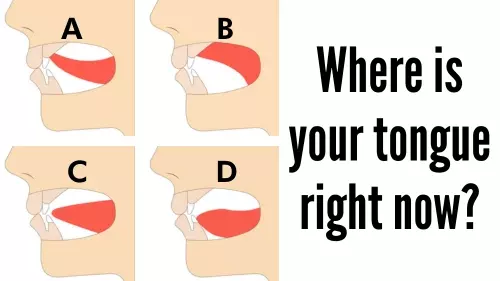 Correct Tongue Position