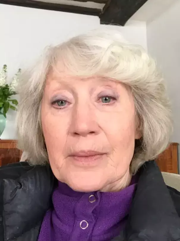 After image of customer 1