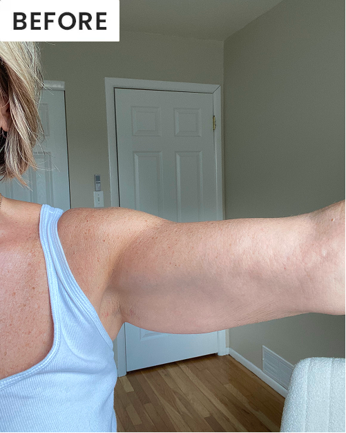 Before image of customer 1