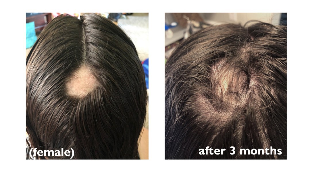 More Hair Naturally Before and After photos, Testimonials and reviews