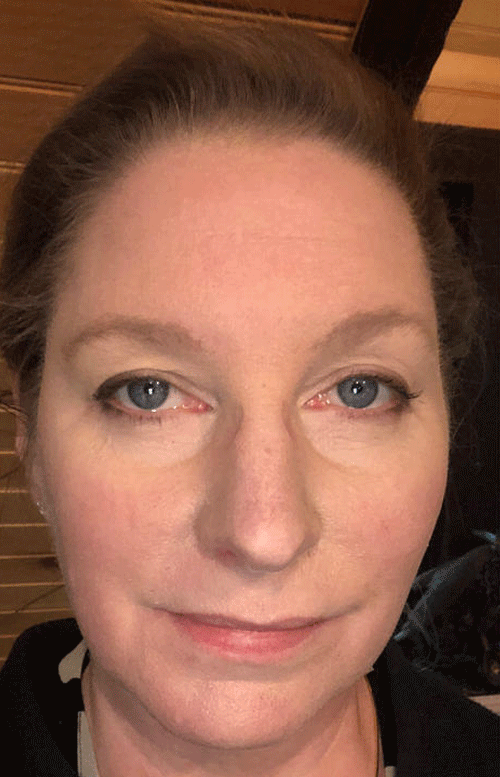 Before After GIF - Review 2