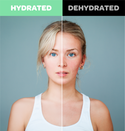 Hydrated & Dehydrated Skin