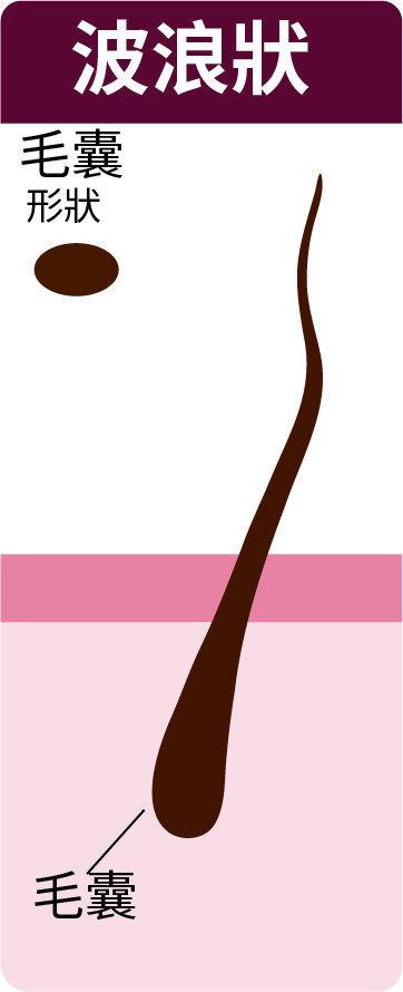 oval follicle -wavy