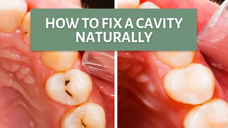 Fix Cavity