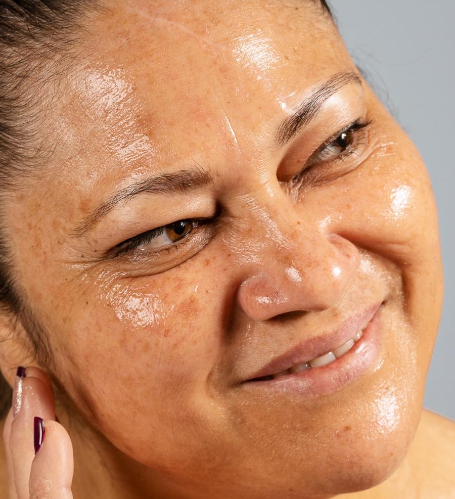 Causes Behind Drooping Eyes