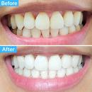 Polar MD Teeth Whitening