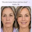 before after picture of customer with review-'this really helped with my eye bags and over skin."