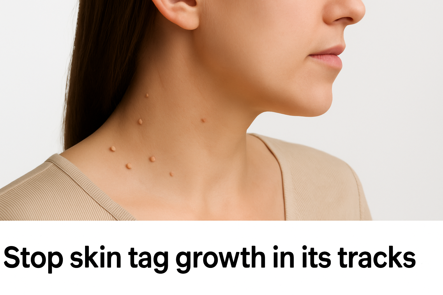 what causes skin tag growth
