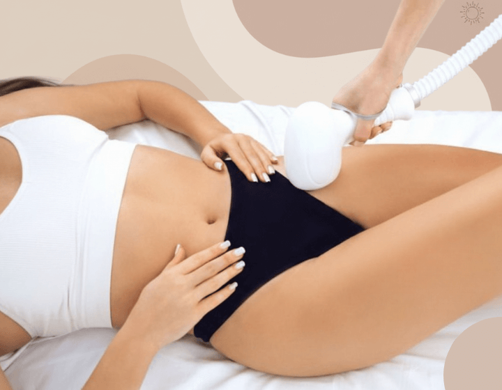 épilation maillot femme