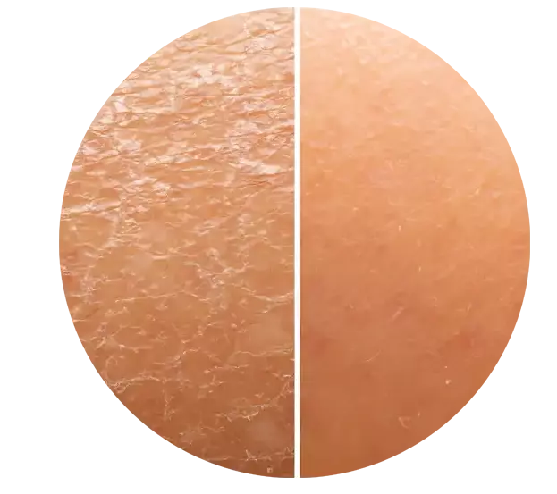 Reduced appearance of Dry Skin