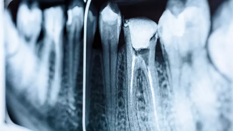 dental-xray