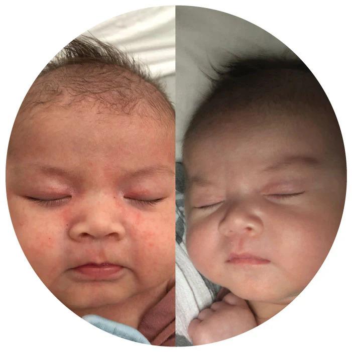 before/after baby photo