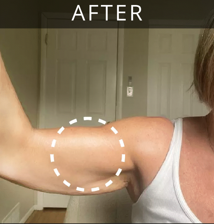 Before - After - Stacey