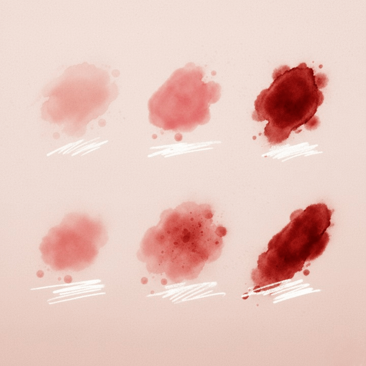 couleur saignement d'implantation photo