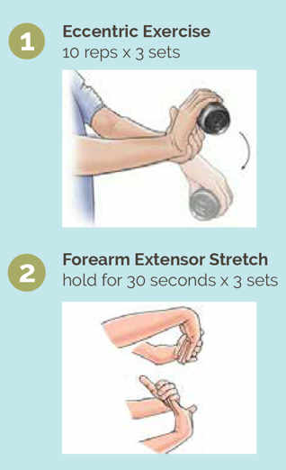 eccentric exercise forearm extensor stretch