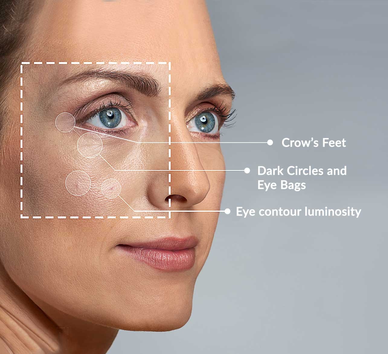 Highlighted eye area with crow's feet, dark circles and eye bags and eye contour luminoosity