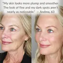 Levaye vitamin c serum before after image