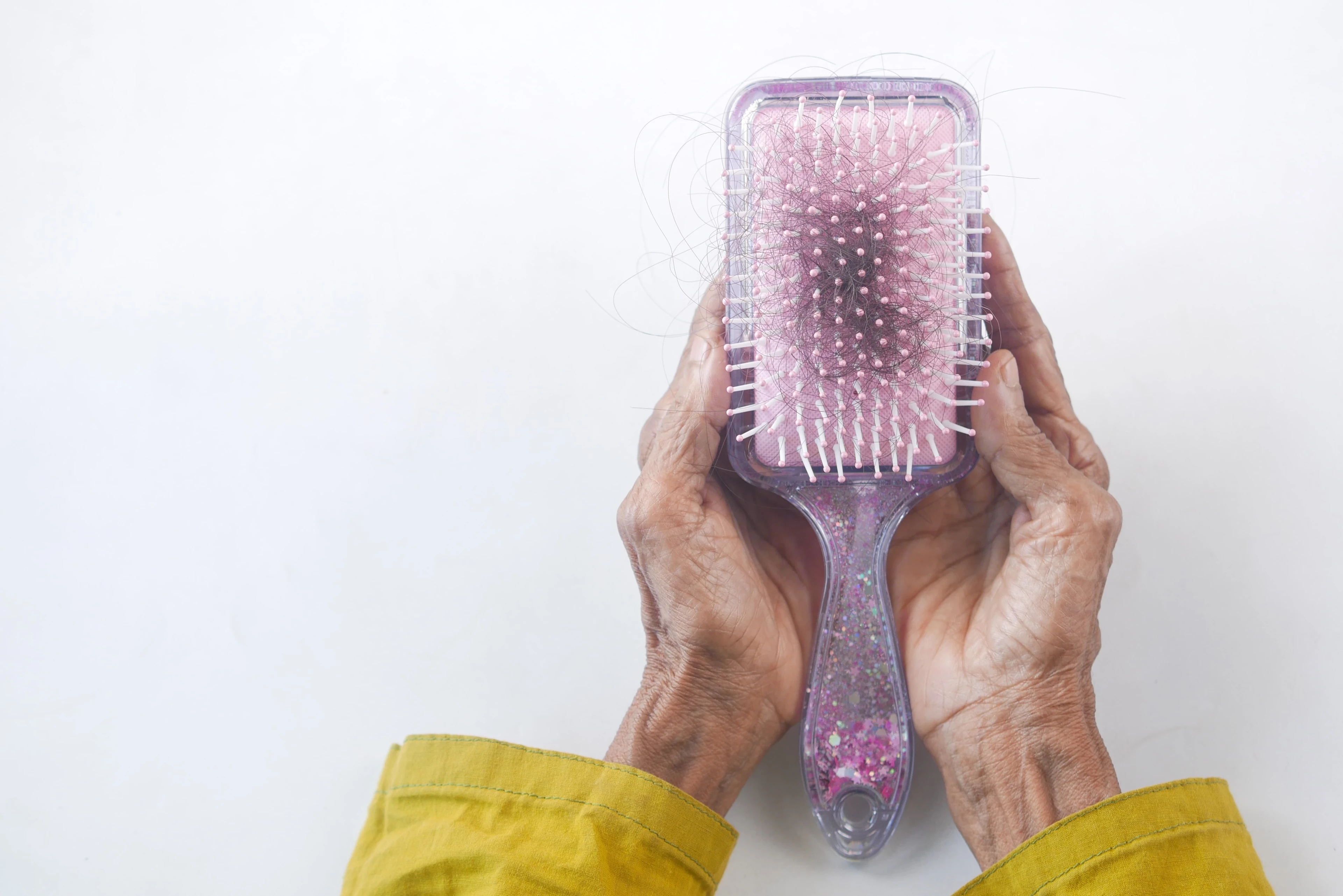 hair loss strands of hair in a brush