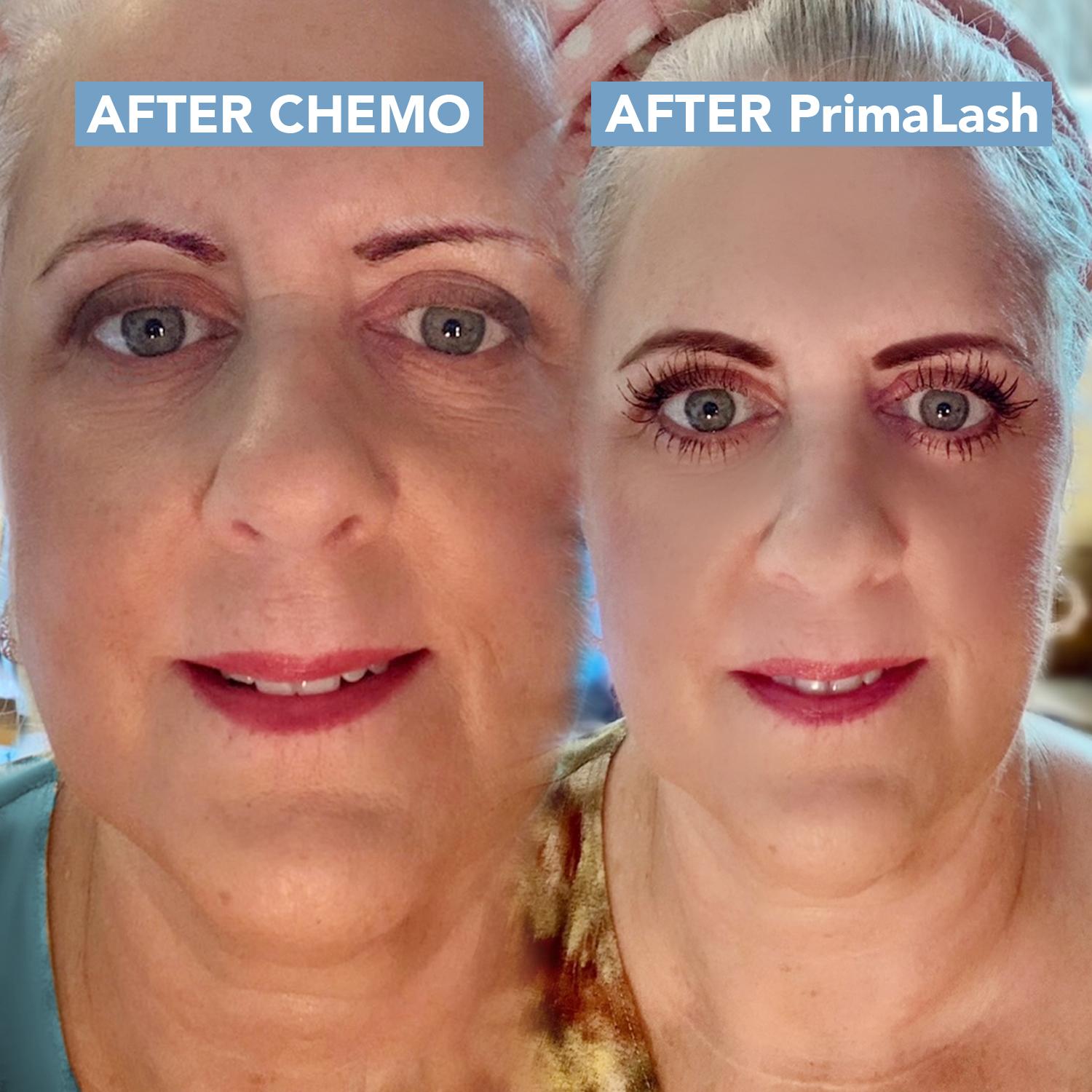 Success After Chemo NL