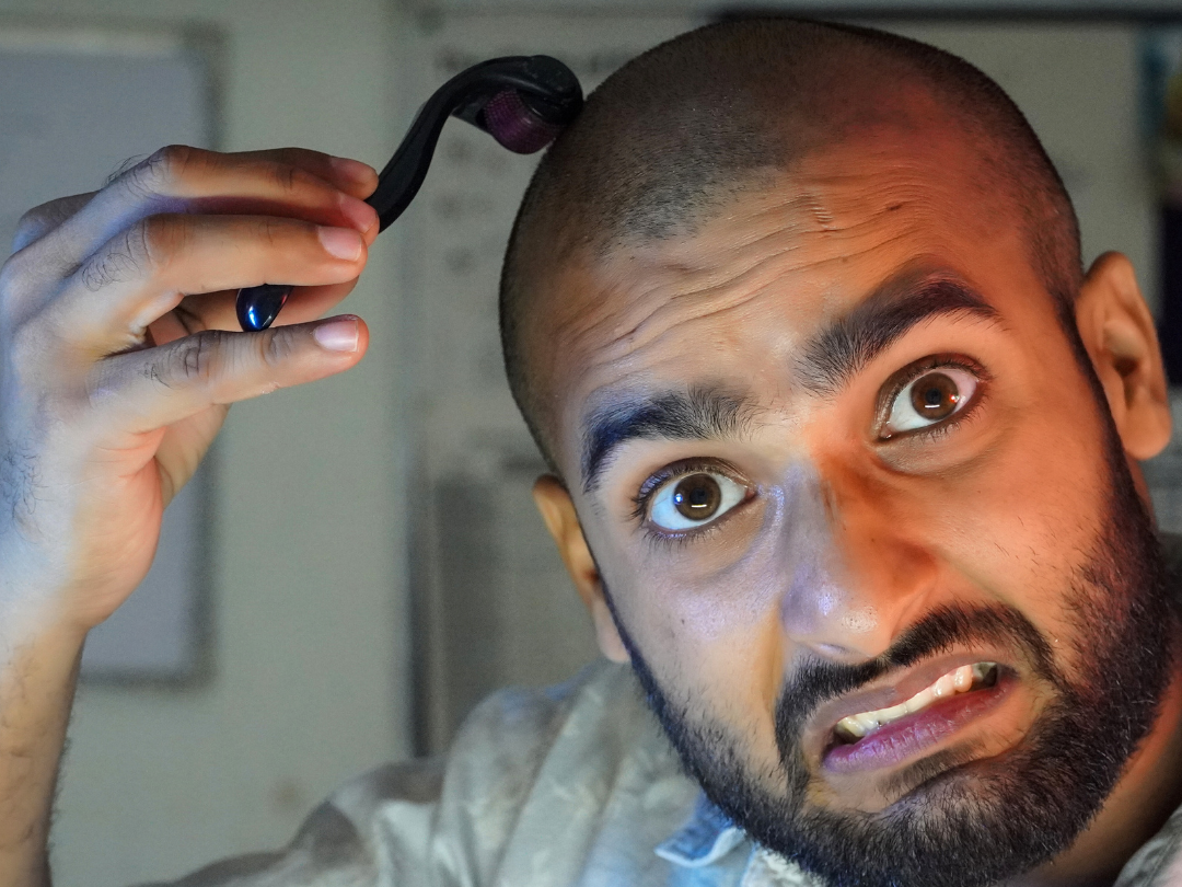 man microneedling his head