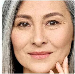 PELE ENVELHECIDA, SECA E DESIDRATADA