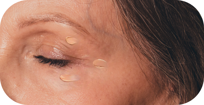 picture of a women with dark circles