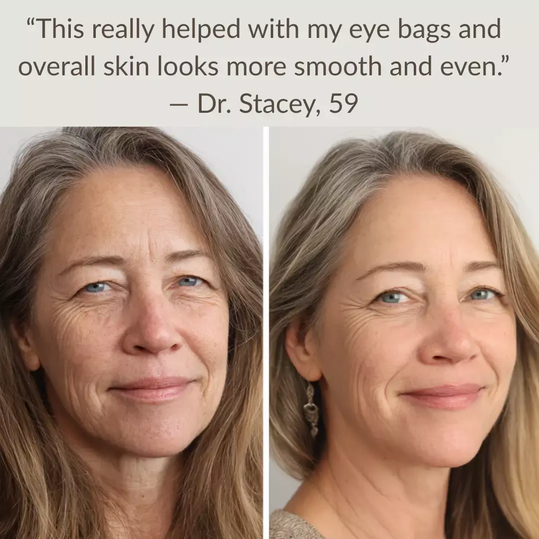 strateva, levaye cosmetics, Strateva Rx