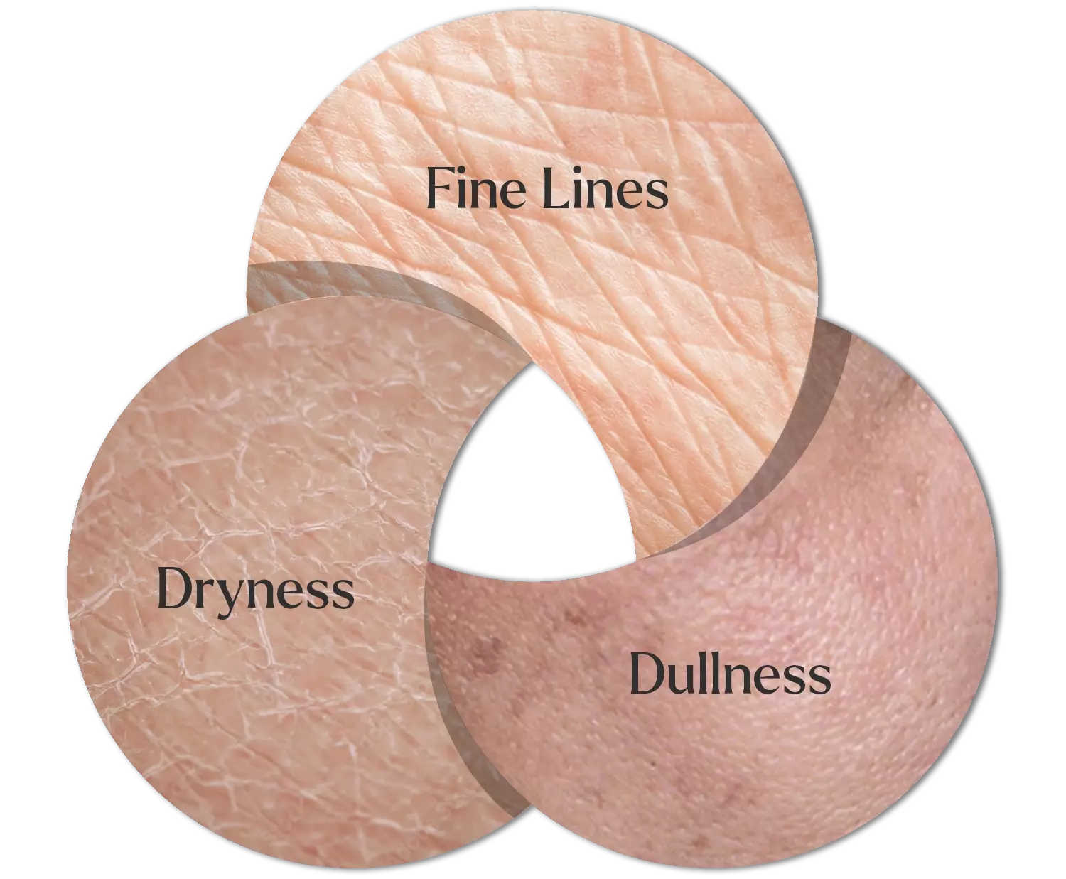 Fine Lines, Dryness and Dullness