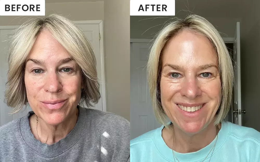 Before image of customer 1