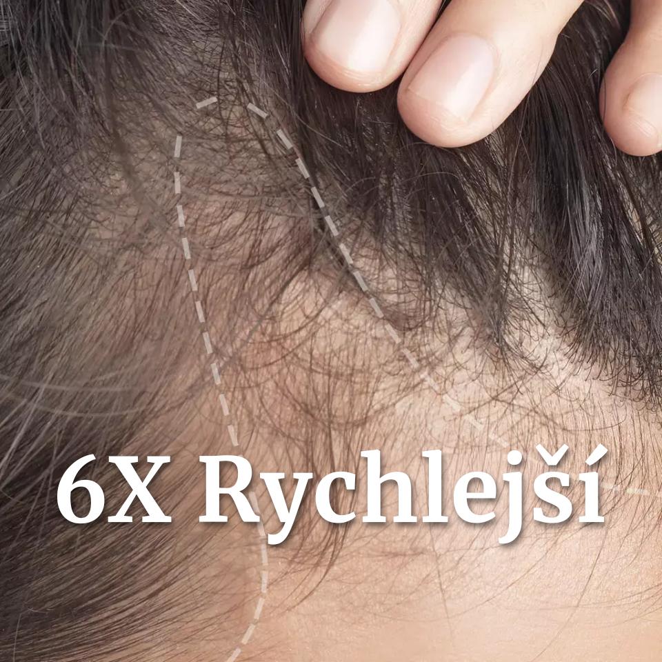 Scalp aging