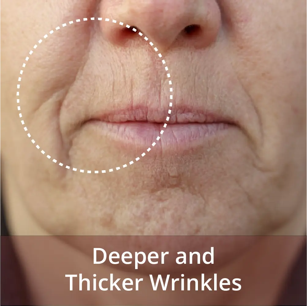 deeper and thicker wrinkles