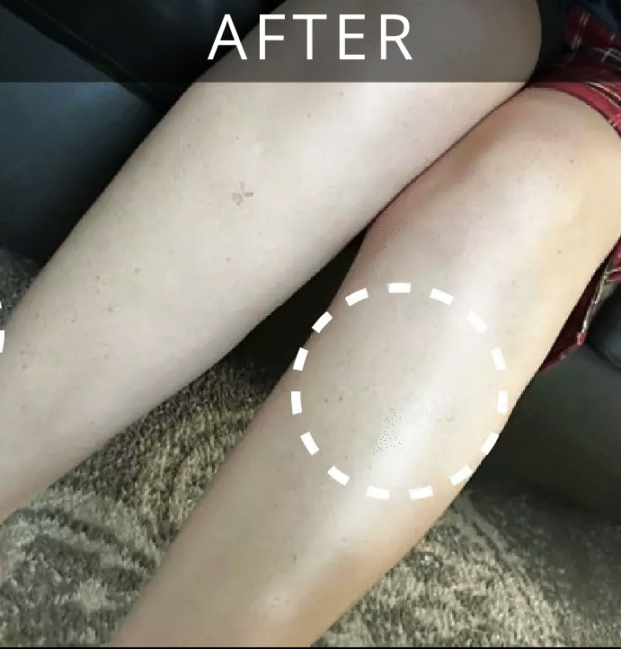 Before - After - Blaque