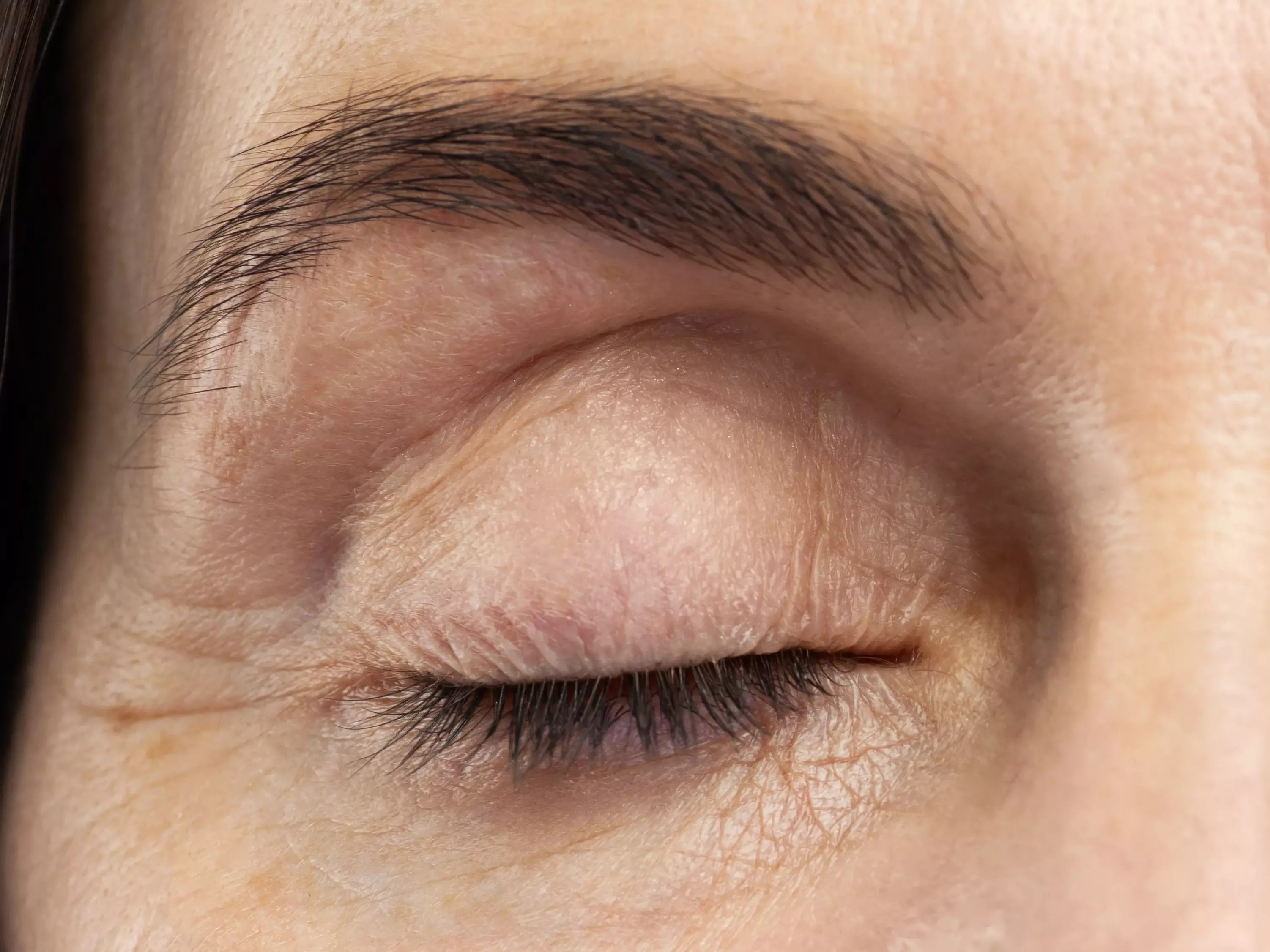 zoomed picture of eyes in late 40s