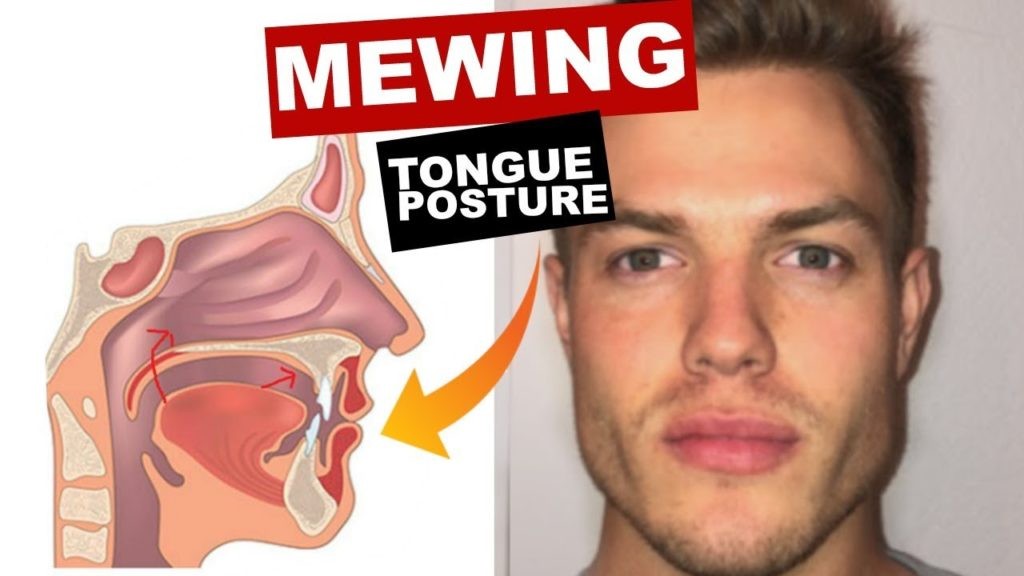 JAWINNER, A popular practice called Mewing