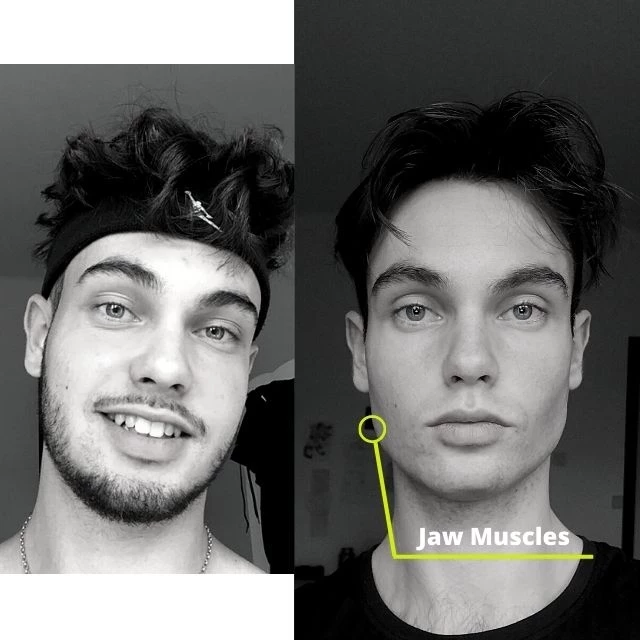 Jaw muscle growth