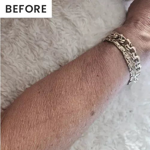 before and after