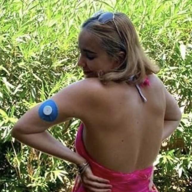 CGM CGM Patches | Continuous Glucose Monitor Accessories | Glucology