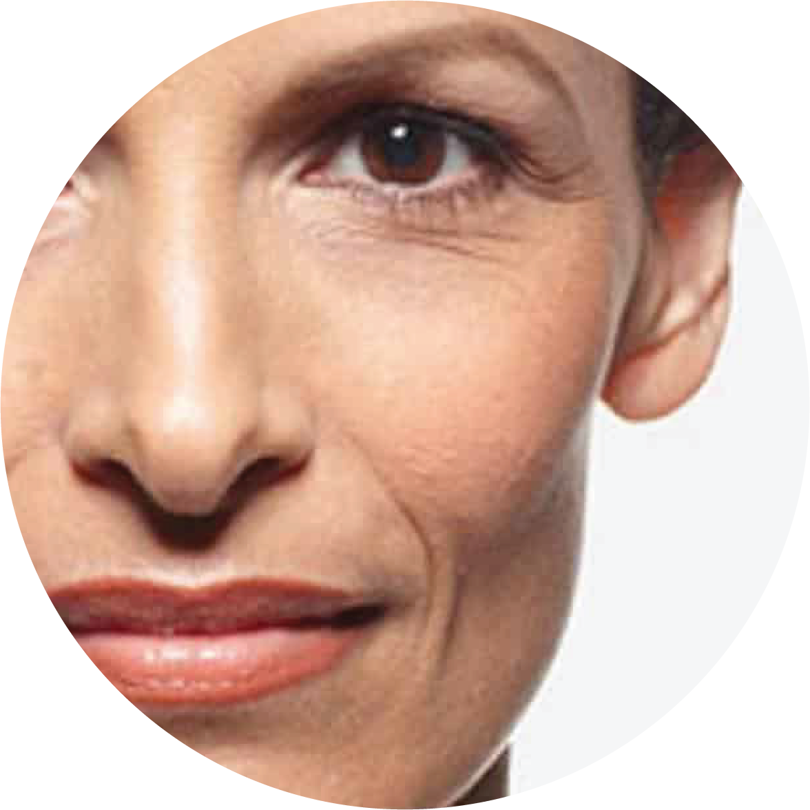 Agining - Wrinkles and Fine Lines