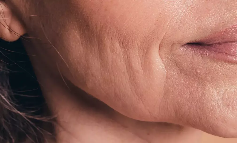 Gravity lines