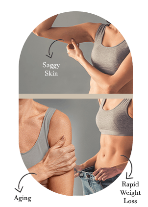 saggy skin