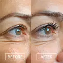 show lash customer before and after eyelashes showing the after with longer looking eyelashes