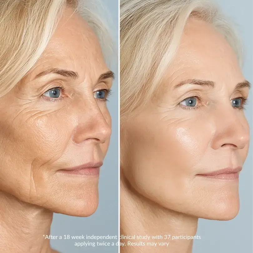 Vitamin C + sculpting serum LeVaye Cosmetics before after photo