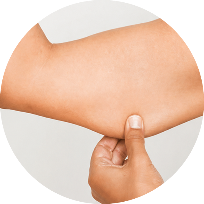 saggy arms and legs