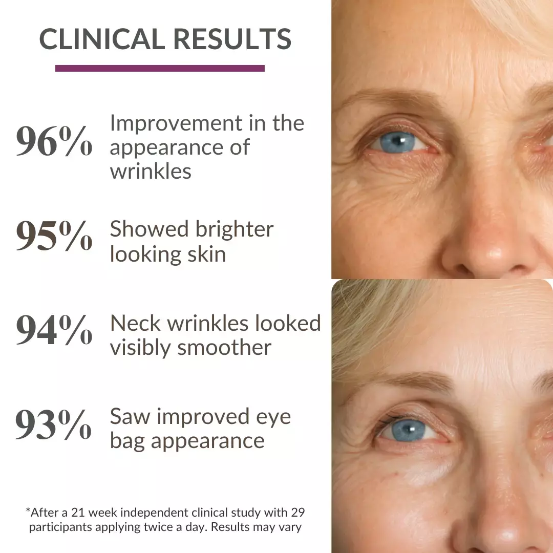 Strateva RX, levaye, levaye cosmetics, Strateva