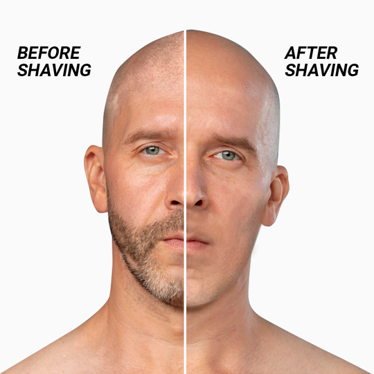 Viper Shaver Platinum - Fast-Smooth-Close-Shave-In-100-seconds