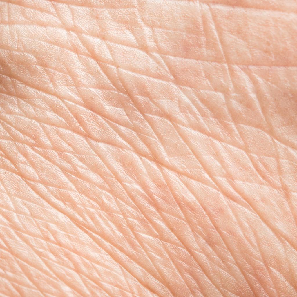 dehydrated, crepey skin