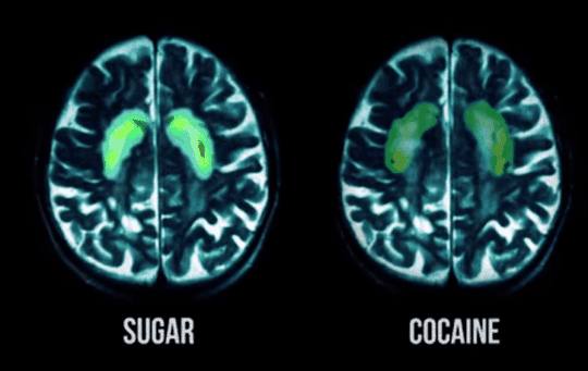 Sugar Cocaine Brain Comparison
